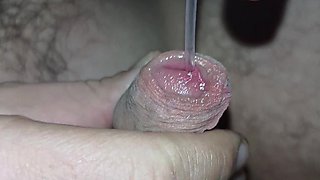 Ureal Insertion I'm Putting a Catheter in My Husband, It Hurts Him