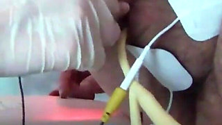 Modified part 2 - extreme electric cbt