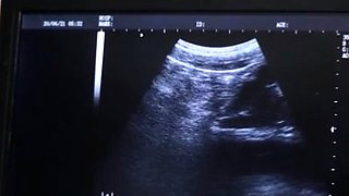 Ultrasound bareback with doctor and teen