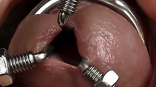 Dilation of the Hole Expanded Glans and Sperm Blockage Through Urethral Insertion of the Finger - Closeup