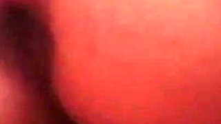Anal Rupture