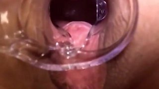 Pussy Inspection with Speculum