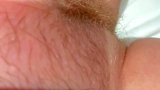 Hairy Labia