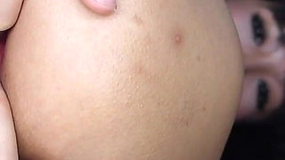 8 Fingers Stretched Anal Gaping Prolapse