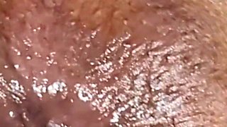 Trying to Get the Sperm Out, It Was so Deep That It Didn't Come Out