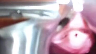 Speculum Cervix & Anal Exam Great View Inside