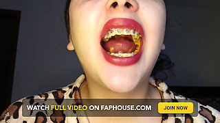 Chew Cheetos POV Uvula