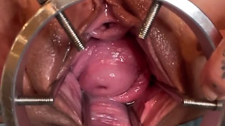 Exploring My Cervix With Sound And Fingers