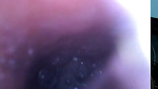 Endoscopy!! Giantess Swallowed a 25 Members at Same Time