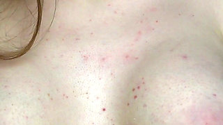 Revealing My Boobs After Breast Reconstruction (3-week Progress Update)