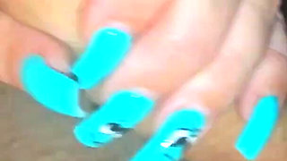 I'm Comforting My Stepmother with a Bruise on Her Butt