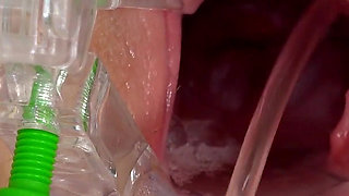 Super Cute Redhead Kaira Love Gets Her Cervix Examined with Speculum