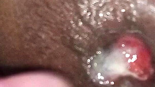 A MILF Girl Had Her Ass Stretched by a Man with a Very Large Penis.