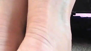 My Dry Feet Heels and Soles