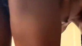 Anal Prolapse