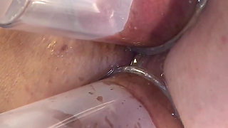 Extreme Close up Double Vacuum Pumping Ass and Pussy