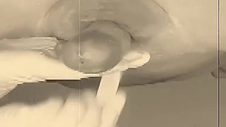 A Nurse in White Gloves Waxes a Guy